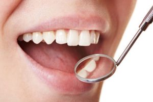 Füllungen - Zahnärztliche Behandlungen